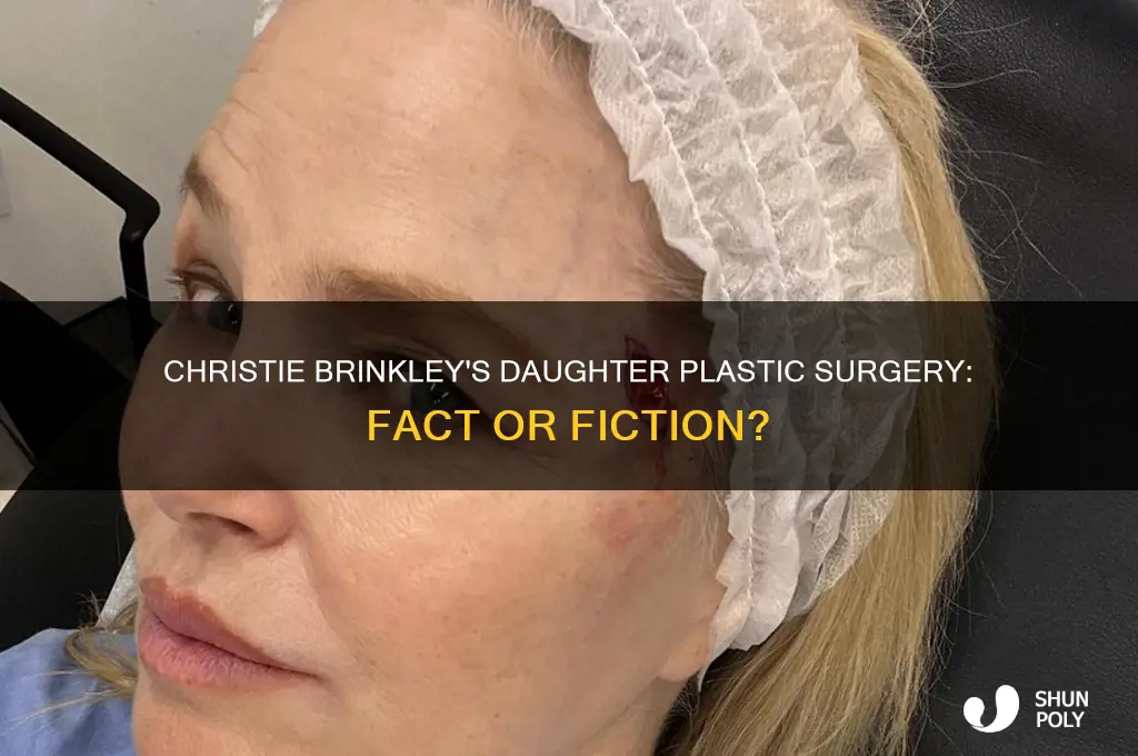 did christie brinkly daughterhave plastic surgery