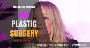 Christina Applegate's Transformation: Plastic Surgery Rumors Explored