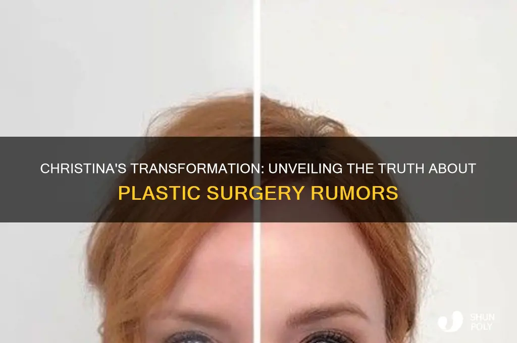 did christina have plastic surgery