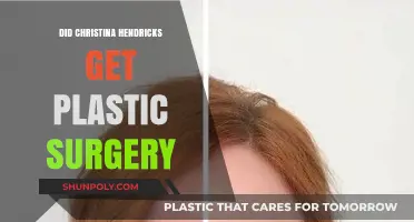 Christina Hendricks Plastic Surgery: Fact-Checking the Rumors and Speculations