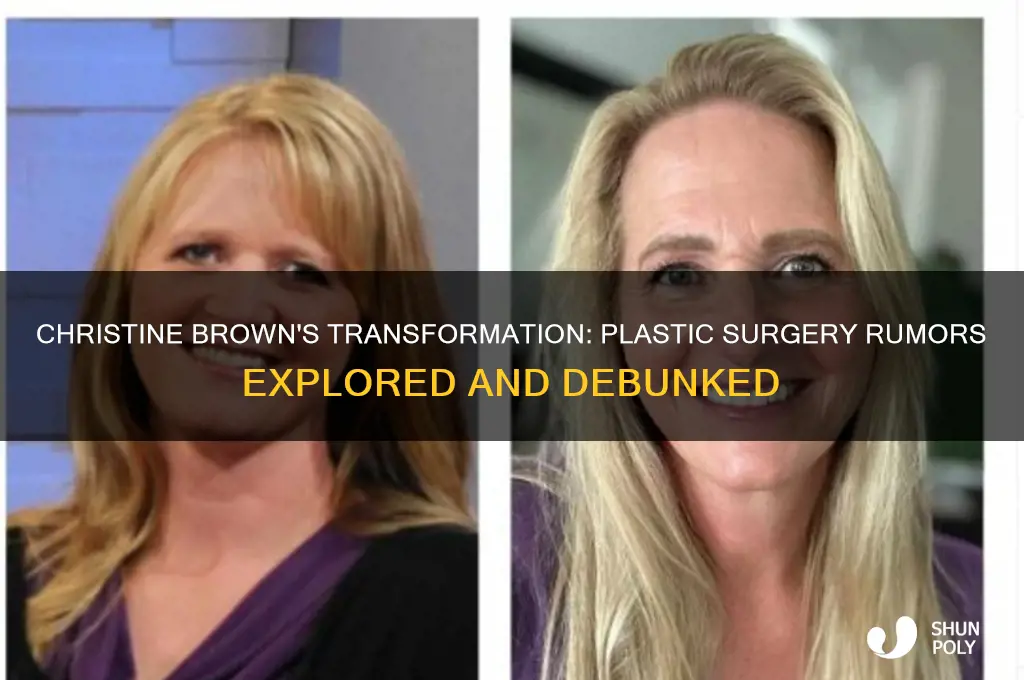 did christine brown have plastic surgery