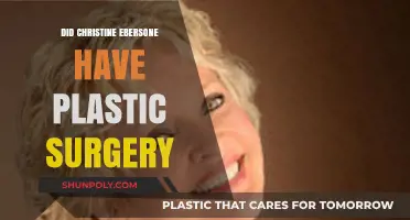 Christine Ebersole's Transformation: Plastic Surgery Speculations and Truths