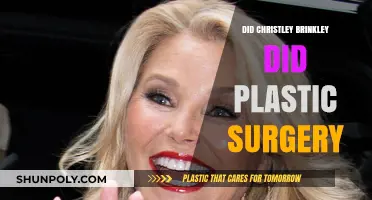 Christie Brinkley's Transformation: Plastic Surgery Speculations and Truths Revealed