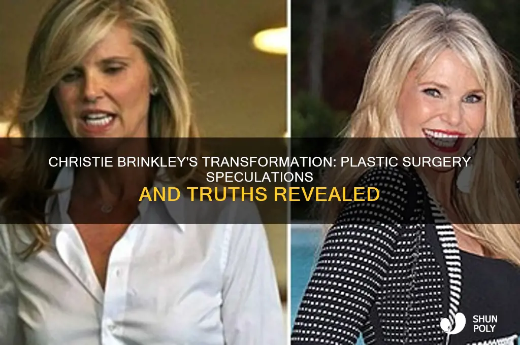 did christley brinkley did plastic surgery