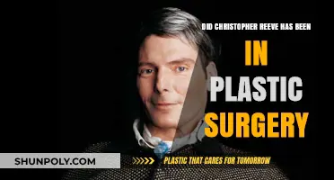 Christopher Reeve's Transformation: Plastic Surgery Rumors Explored