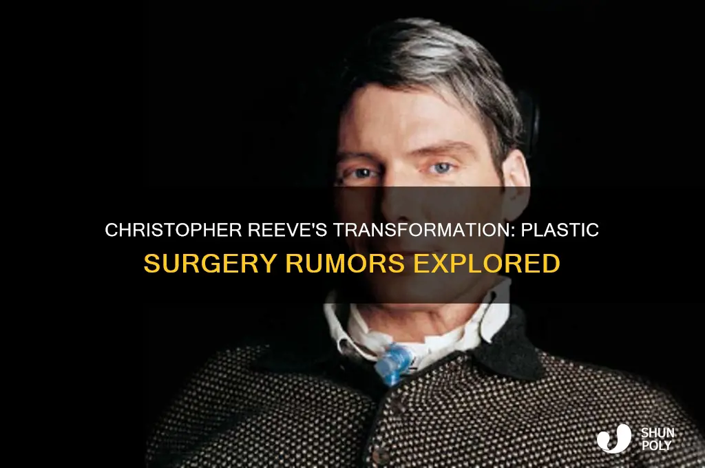 did christopher reeve has been in plastic surgery
