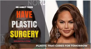 Christy Teigen's Transformation: Plastic Surgery Speculations and Truths Revealed