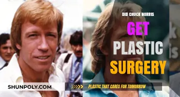 Chuck Norris Plastic Surgery Rumors: Fact or Fiction?