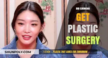 Chungha's Transformation: Plastic Surgery Speculations and the Truth Behind It