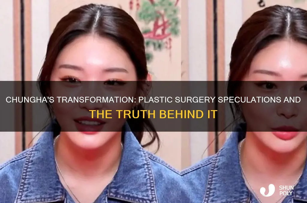 did chungha get plastic surgery