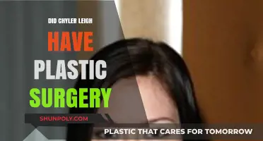 Chyler Leigh's Transformation: Plastic Surgery Rumors Explored