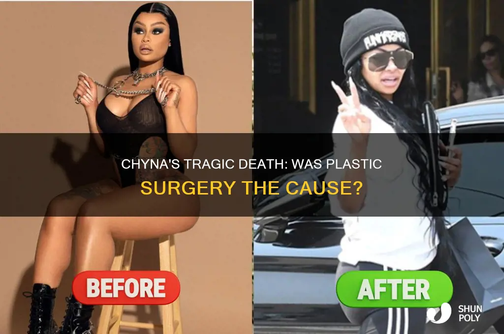 did chyna die from a plastic surgery