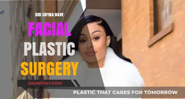 Chyna's Transformation: Unveiling the Truth About Her Facial Surgery
