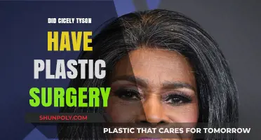 Cicely Tyson's Ageless Beauty: Plastic Surgery Speculations Explored