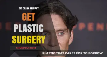 Cillian Murphy's Transformation: Plastic Surgery Rumors Explored and Debunked