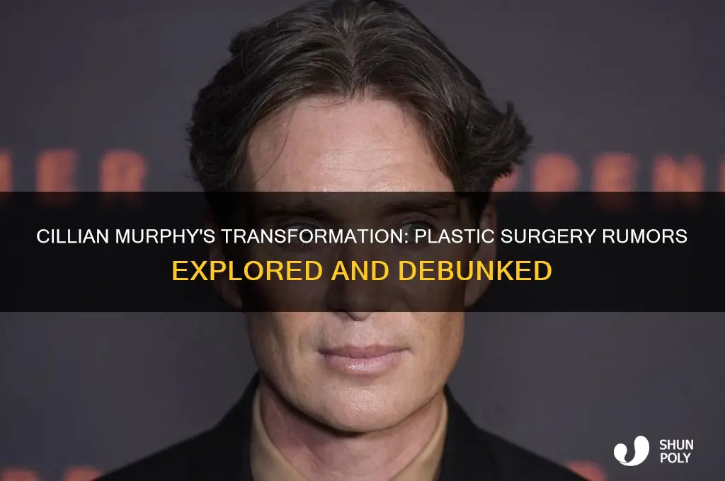 did cilian murphy get plastic surgery