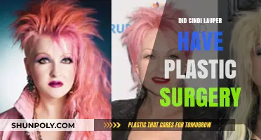 Cindy Lauper's Transformation: Plastic Surgery Rumors and Reality Revealed