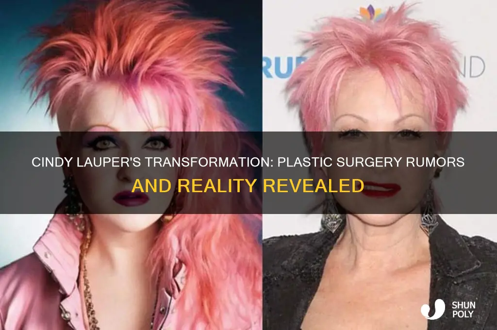 did cindi lauper have plastic surgery
