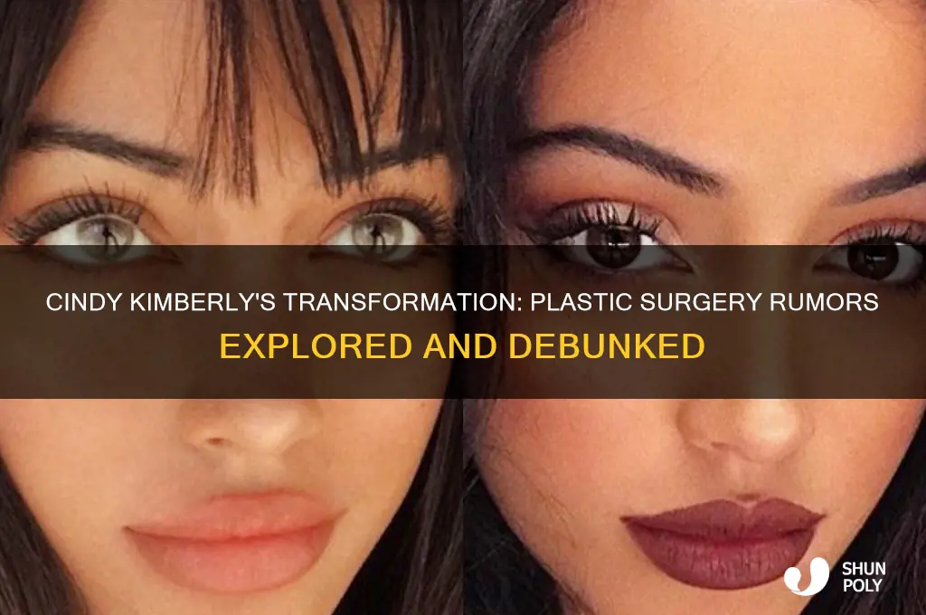 did cindy kimberly get plastic surgery