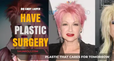 Cindy Lauper's Transformation: Plastic Surgery Rumors and Reality Revealed
