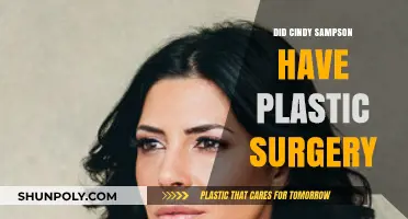 Cindy Sampson Plastic Surgery: Fact-Checking the Rumors and Speculations