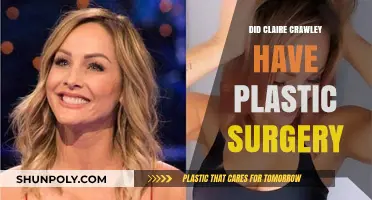 Claire Crawley's Transformation: Plastic Surgery Rumors Explored and Debunked