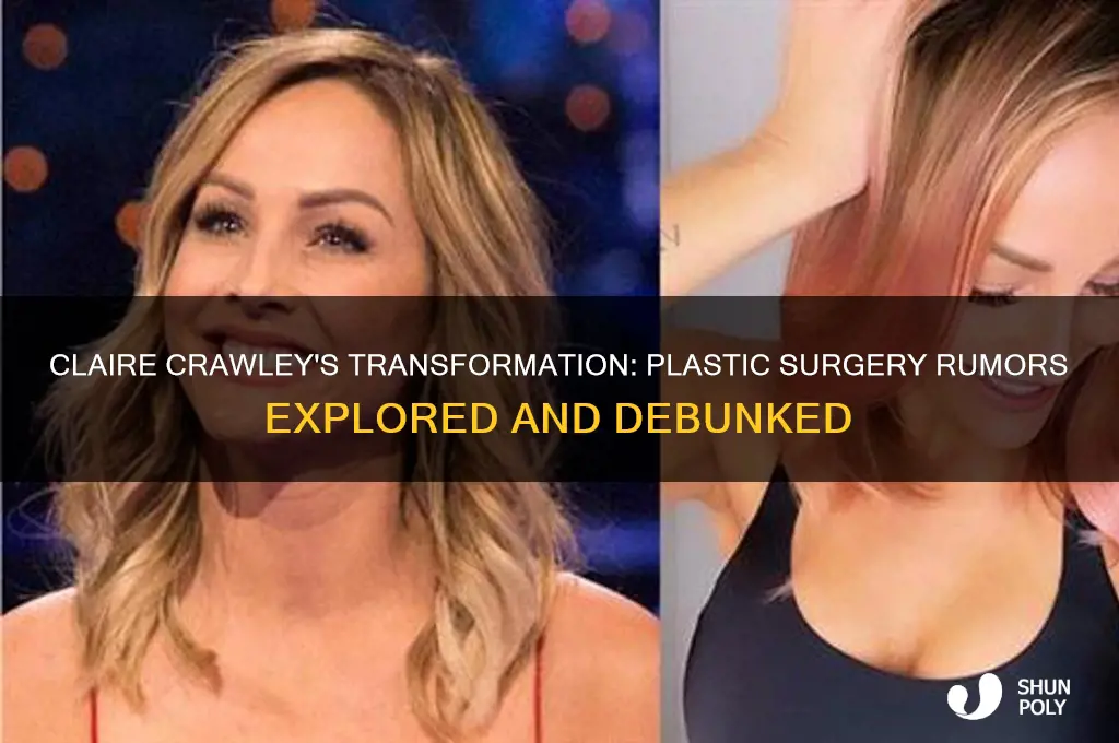 did claire crawley have plastic surgery