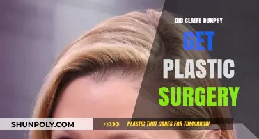 Claire Dunphy's Transformation: Plastic Surgery Rumors Explored and Debunked