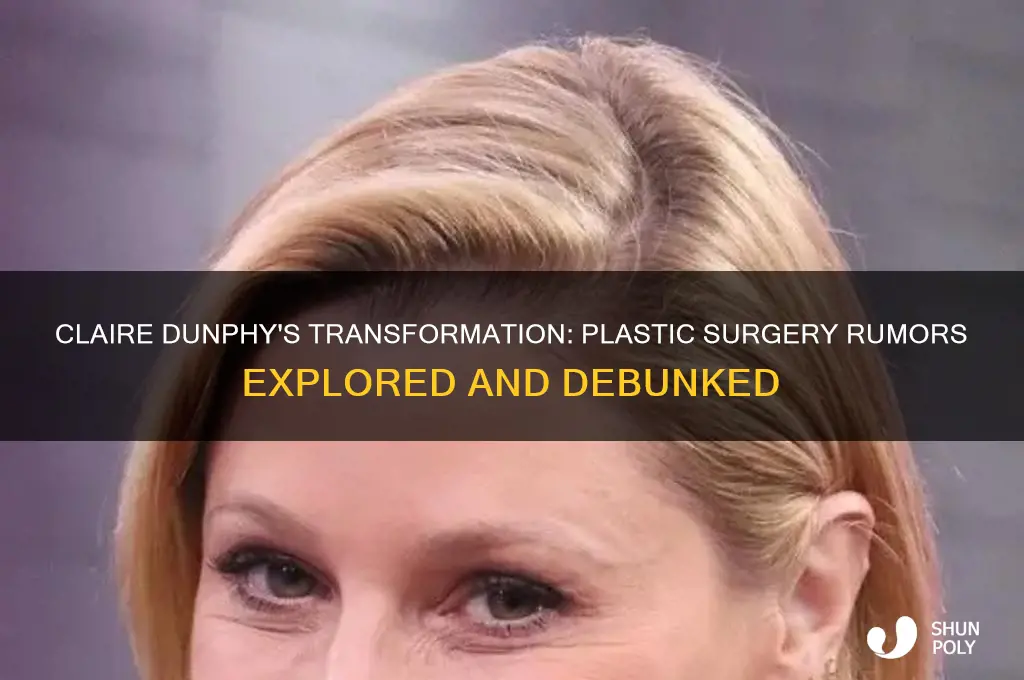 did claire dunphy get plastic surgery