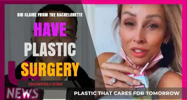 Claire's Transformation: Plastic Surgery Rumors on The Bachelorette