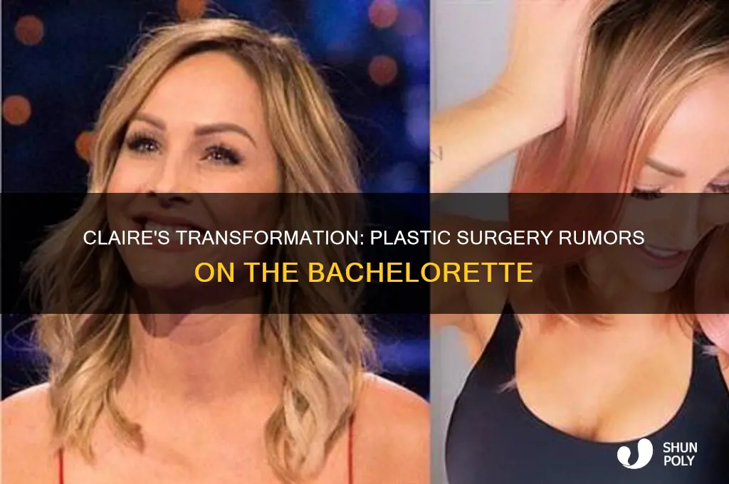 did claire from the bachelorette have plastic surgery