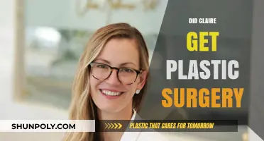 Claire's Transformation: Plastic Surgery Rumors and the Truth Behind Them