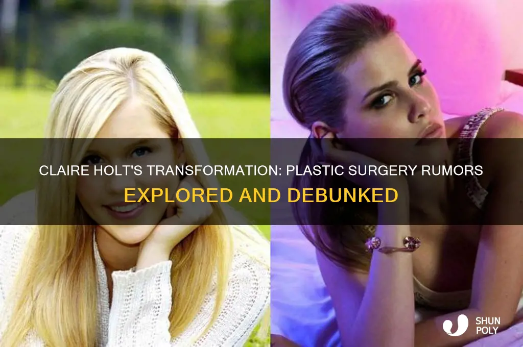 did claire holt get plastic surgery