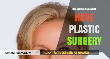 Claire McCaskill's Appearance: Plastic Surgery Speculations and Truths
