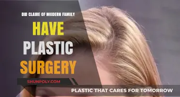 Claire Dunphy's Transformation: Plastic Surgery Rumors in Modern Family