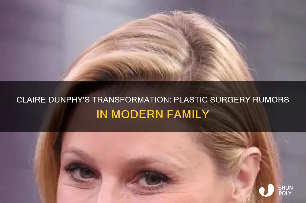 did claire of modern family have plastic surgery
