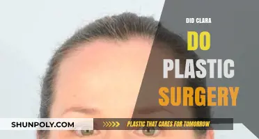 Clara's Transformation: Plastic Surgery Rumors and the Truth Behind Them