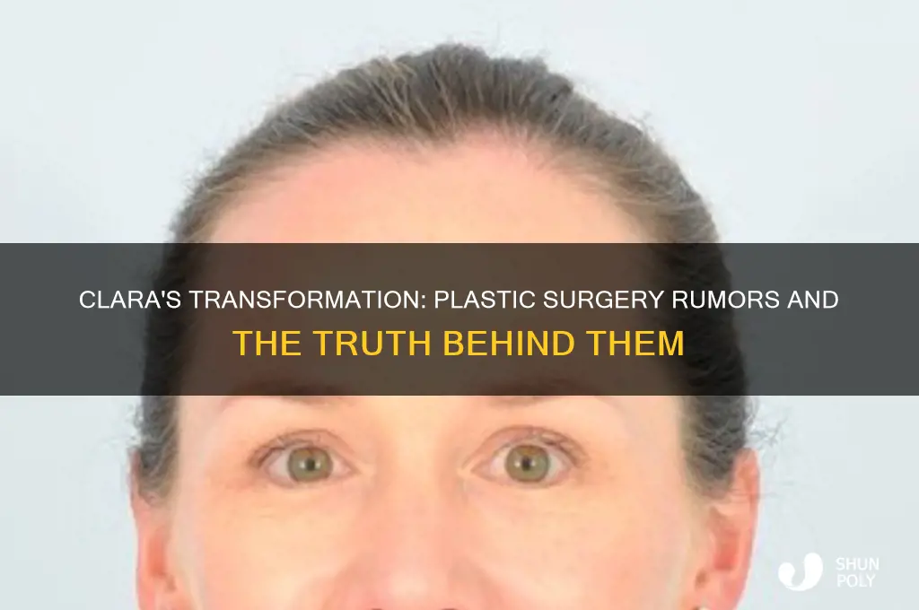 did clara do plastic surgery