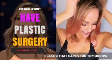 Clare Crawley's Transformation: Plastic Surgery Speculations and Truths Revealed