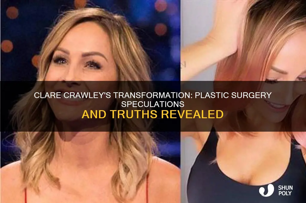 did clare crowley have plastic surgery