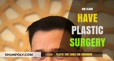Did Clare Undergo Plastic Surgery? Uncovering the Truth Behind Her Look
