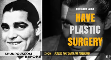 Clark Gable's Plastic Surgery: Fact or Fiction? Unveiling the Truth