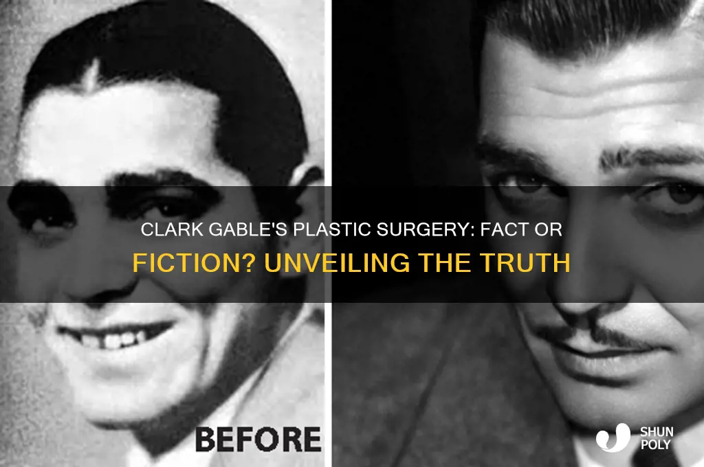 did clark gable have plastic surgery