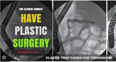 Claudia Conway's Transformation: Plastic Surgery Speculations and Truths Revealed