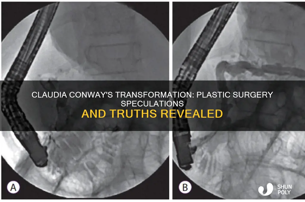 did claudia conway have plastic surgery
