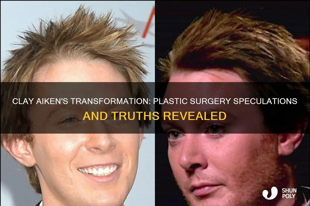 did clay aiken have plastic surgery