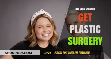 Clea Shearer Plastic Surgery: Fact-Checking the Makeover Rumors