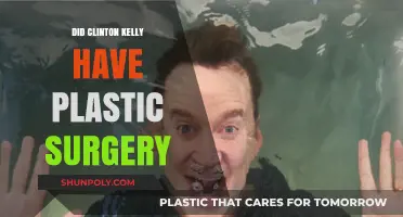 Clinton Kelly's Transformation: Plastic Surgery Rumors Explored and Debunked