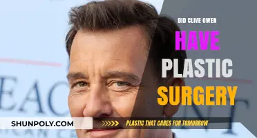 Clive Owen's Changing Looks: Plastic Surgery Rumors Explored