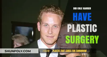 Cole Hauser's Transformation: Plastic Surgery Rumors Explored and Debunked